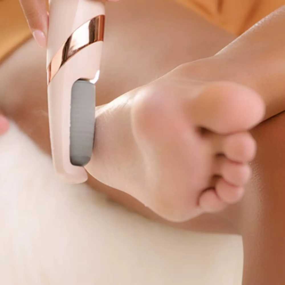 Rechargeable Electric Callus Remover – Cordless Foot File