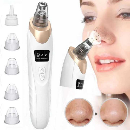 5-in-1 Electric Blackhead Remover Pore Vacuum