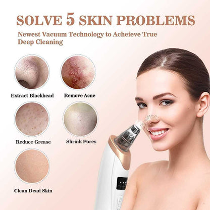 5-in-1 Electric Blackhead Remover Pore Vacuum