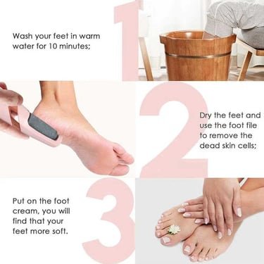 Rechargeable Electric Callus Remover – Cordless Foot File - Image 3